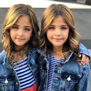 12 Years Ago They Were Called The World’s Most Beautiful Twins – Now Look At Them