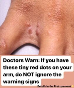 If You Have These Tiny Red Dots On Your Arm, Do Not Ignore The Warning Signs..