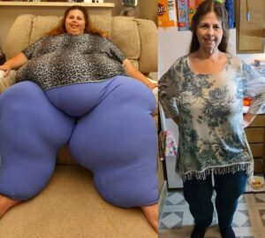 From 518 Pounds – Her Shocking Transformation